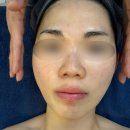 피부체인지 | 안산 본오동 피부관리 페이스체인지로 윤곽 살아난 가꾸미 스킨앤바디 후기