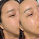 티메드 | 피부 진정앰플추천 마메드러뷰티 아줄렌앰플