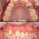 정우영치과의원 네이버블로그