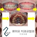 로미오치과교정과치과의원 네이버블로그