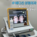 에디션성형외과의원 | [ 강남 에디션성형외과 ] 울쎄라 300샷 한달 후기