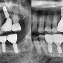 두정서울비디치과의원 이미지