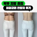 제앤씨세탁하는사람인 | 복부지방흡입 가격 허파고리 수술 한달 후기 붓기 부작용 총정리