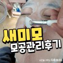 새미모 | 포항 피부관리 모공관리잘하는 새미모 슉클리어 후기
