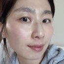 김해 장유 재방문 에스테틱 엘리유스킨 피부결 관리 엑스터 시술 후기