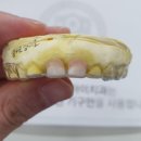 하이교정치과기공소 이미지