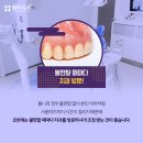 헤리치과의원 네이버블로그