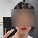 연신내약국 | 연신내 W뷰티 입술문신 2달뒤 후기 + 부작용