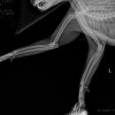 Monteggia fracture 이미지