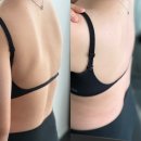 파워슈로스 운동센터 | 청라필라테스⎮엠엠필라테스 '청소년 척추측만, 슈로스 8개월차 후기'