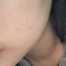 뷰티디바이스 얼굴마사지기 쿼드쎄라 펜타 사용후기, 집에서 탄력 케어 시작!