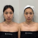 플라이불 | 상무지구 피부관리 보니토에스테틱에서 플라모드 받고 온 후기