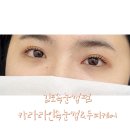 뷰티인속눈썹 | 김포속눈썹펌 카라라인속눈썹&두피케어_ 블랙클리닉펌 후기