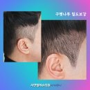 명지헤어라인