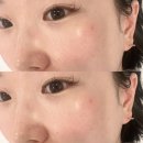 씨유진주혁신풀에버 | 진주 혁신 에스테틱 , 채지움뷰티에서 피부관리 후기