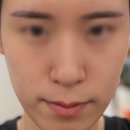 명한의원 | 안면비대칭교정, 모델과 연예인들이 찾는 안면비대칭한의원 교정 후기 및 가격