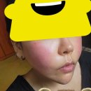 [홍조 극복기 3탄] 무너진 피부 장벽 스킨케어 다이어트 루틴 &amp; 다이소 진정템 내돈내산 후기
