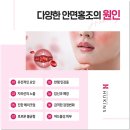 휴킨스 스킨케어