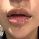 화이트성형외과의원 이미지