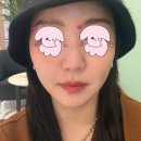 리본성형외과의원 | 신사역 실리프팅 리본성형외과 팔자주름 리프팅 후기 자연스럽게 개선된 솔직 후기