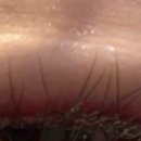 컴포트성형외과의원 이미지