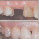 치과(발전하는 임플란트 시술) 이미지
