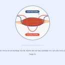 웰메디칼 이미지