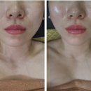 진스킨엔바디 네이버블로그