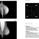 누리헬스케어 이미지