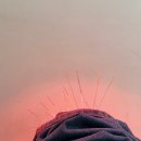 유진한의원 | [당산역] 침 잘 놓는 전통 한의학의 진수, 유진한의원