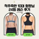 웃음운동 | [척추측만 운동후기] 슈로스 운동 후 웃음을 되찾은 10대 여학생 회원님의 후기