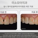 레진치과의원 네이버블로그