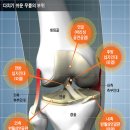 몸 굳는 노인들 살짝 넘어져도 무릎 다치기 쉬워 이미지