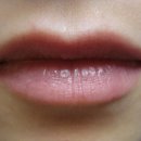 미자인의원 이미지