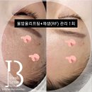 프레쉬브로우