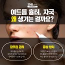 에스엔비의원 이미지