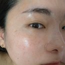 정왕동피부관리 피부지우개로 기미 지운 후기 구은희에스테틱