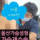 BK타이어 | [울산가슴성형·울산가슴재수술] 10년 만에 터진 보형물, 안전한 교체로 다시 편안함 찾은 후기