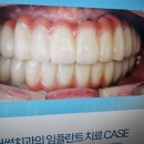 어썸치과의원 이미지