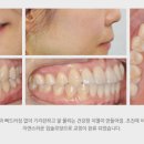 미소치과의원 이미지