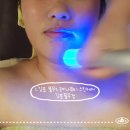 민뷰티스킨테라피 | [김포피부관리] 로이나뷰티 스킨케어 김포풍무점 │ 카복시테라피 윤곽관리 후기