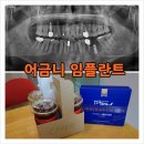 블루덴치과의원 이미지