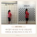 척추앤보상 | 메디컬PT 메디앤핏 중간점검 Before & After 메디컬PT 10회 받은 후기