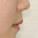 미소로치과의원 이미지