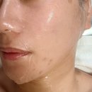 뷰티 앤 슬림 | 울산 삼산동 윤곽관리 뷰티앤슬림 얼굴라인관리 후기