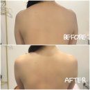 가온요양병원 | 온천동에스테틱 &#34;가온뷰티&amp;바디센터&#34; 에너지 등관리 후기 🔋