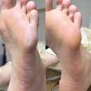 양산 덕계 패디플래닝 후기 더노뷰티