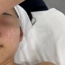 아르케스킨앤바디 울산점 | 울산 남구 에스테틱 삼산동 여드름관리 아르케스킨앤바디 울산점
