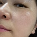 제인 스킨케어 | 민감성피부 스킨케어제품 추천 : 그링브 스킨로션후기