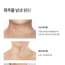 몬스터클리닉